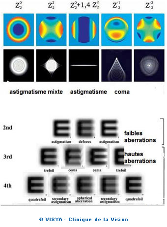 Dynamic Rotational Eye Tracking