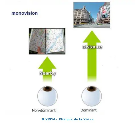 LA MONOVISION