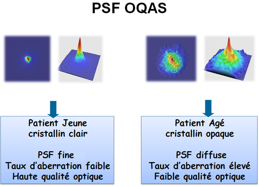 PSF OQAS