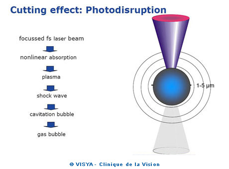 Cutting effect: Photodisruption