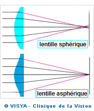 Lentille sphérique