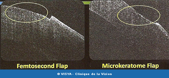 Femtosecond Flap