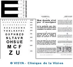 LES MESURES DE LA VISION