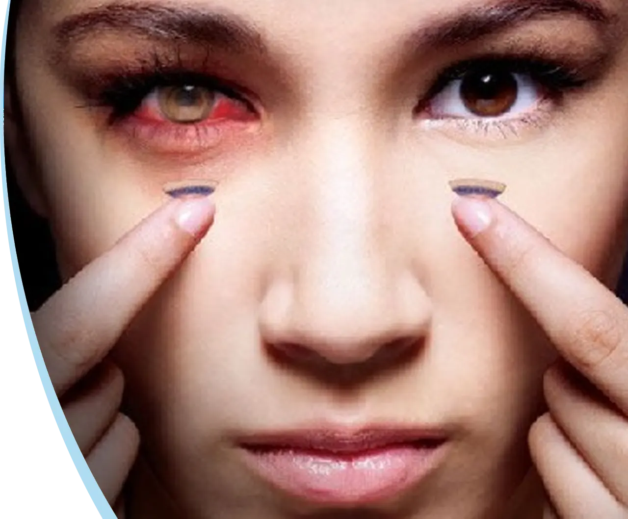 Les défauts optiques visuels sont opérables chez l’adulte