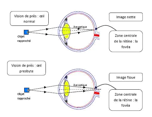 LES BINOCLES - Tout sur la vue